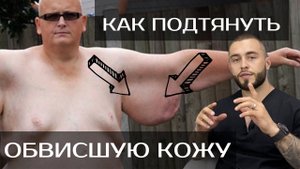 Обвисшая кожа на руках: как подтянуть ее и убрать дефект ?