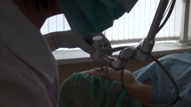 Удаление кератомы на лице фракционным СО2 лазером.