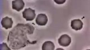 Макрофаг ловит бактерию. Macrophage catches bacterium