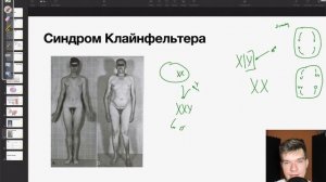 Синдромы Тернера и Клайнфельтера | Биология ЕГЭ