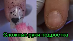 Сложные руки подростка