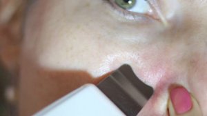 Ультразвуковой скрабер