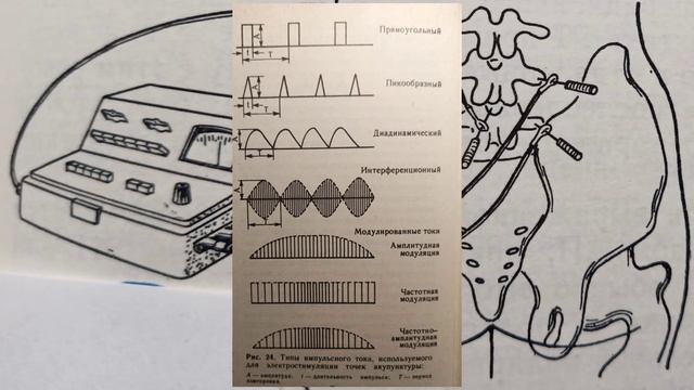 электроакупунктура на практике и фармакопунктура, электропунктура