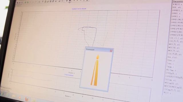 ЖД больница Спираграфия смотреть онлайн