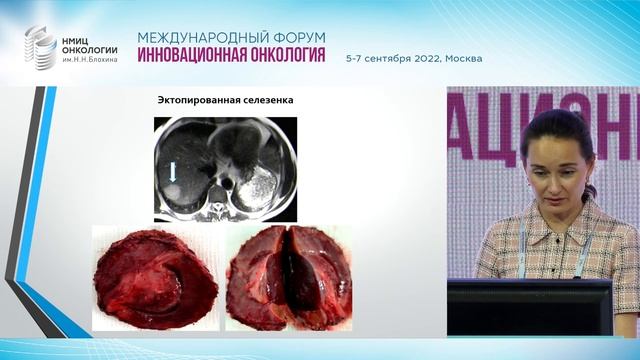 Сложности лучевой диагностики раннего ГЦР. Медведева Б.М. смотреть онлайн