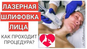 ЛАЗЕРНАЯ ШЛИФОВКА ЛИЦА, ПИГМЕНТАЦИЯ, ОМОЛОЖЕНИЕ, РУБЕЦ, ШРАМ