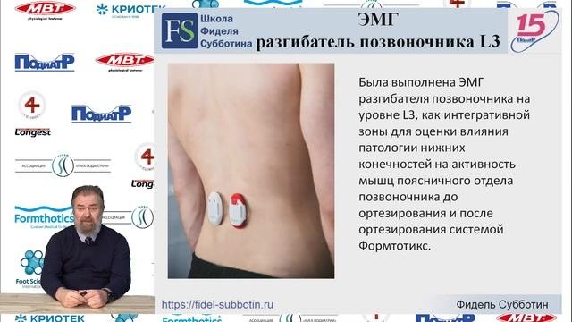Фидель Субботин. Объективизация ортезирования методом интегративной поверхностной электромиографии