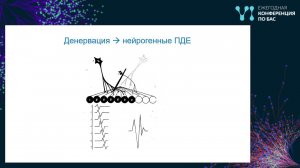 Электронейромиография в дифференциальной диагностике болезней двигательного нейрона