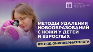 Методы удаления новообразований с кожи у детей и взрослых: взгляд онкодерматолога.