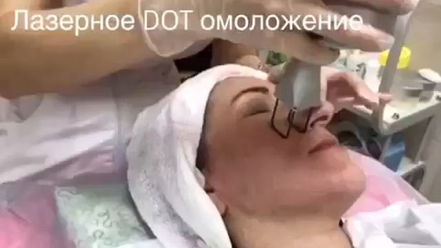 фраксель Дот лазерная шлифовка VID 20170117 WA0005 смотреть онлайн