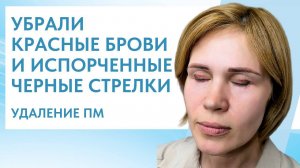УДАЛИЛИ НЕУДАЧНЫЙ ТАТУАЖ БРОВЕЙ И ВЕК \ УДАЛИЛИ КРАСНЫЙ ТАТУАЖ