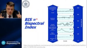 Мониторинг глубины анестезии Лебединский К.М.