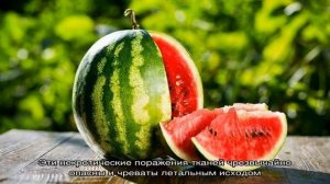 Можно ли есть арбуз при диабете 2 типа