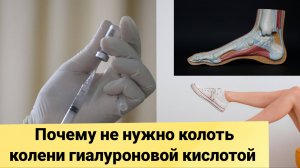 Почему не нужно колоть гиалуроновую кислоту при заболевании коленных суставов