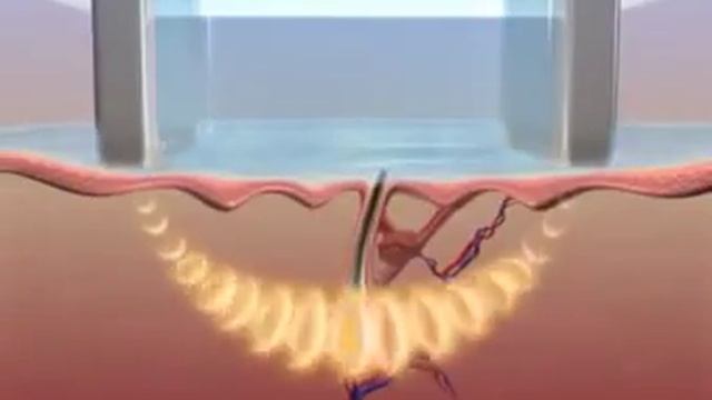 Как работает Элос смотреть онлайн