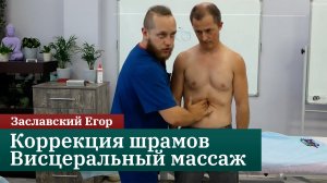 Коррекция шрамов. Висцеральный массаж. Заславский Егор