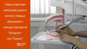 Фторлак - противокариесная и профилактическая жидкость.