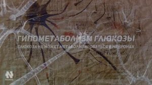 Лучшее для твоего мозга! Как улучшить работу мозга в 5 раз (научно доказано)