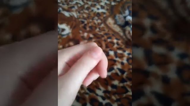 Диагностика заболеваний по ногтям.