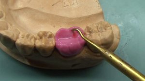 Dental Wax Up Molar 36 [Waxup Tutorial with explanation] for dental study and dental technician