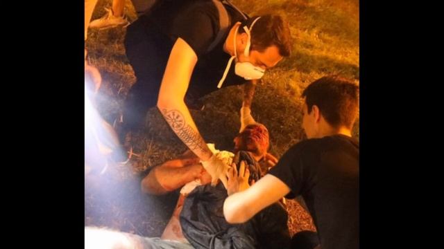 В Белоруссии протестующему разорвало грудную клетку гранатой