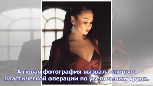 Поклонники уверены, что ляйсан утяшева сделала пластику груди