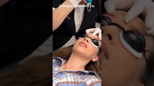 лезерное удаление перманентного макияжа💈