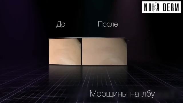 New nova derm смотреть онлайн