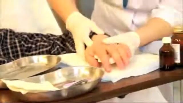 Уход за ногтями больного смотреть онлайн