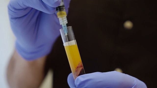 Правила получения плазмы - Plasmatherapy FAQ by Dr. Shkolnyi смотреть онлайн