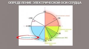 О ЧЕМ РАССКАЖЕТ ЭКГ. ЧАСТЬ 2. РАСШИФРОВКА ЭКГ. РАЗБОР ПРИМЕРОВ ЭКГ #экг #ДокторАлексейЛазарев