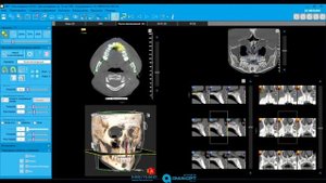 NNT viewer. Краткий обзор для пользователей
