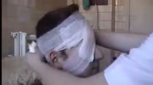 Монокулярная повязка