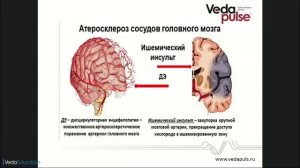 Хронический алкоголизм. Как алкоголь влияет на сердце и головной мозг