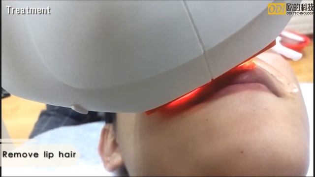 OPT Hair removal+yag laser tattoo removal+RF rejuvenation смотреть онлайн