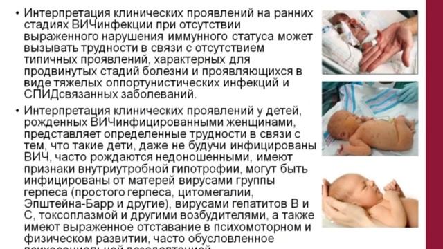 ВИЧ инфекция у детей