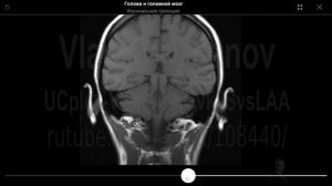 Продолговатый мозг.  МРТ.  "Наш Пирогов". Лекция для студентов