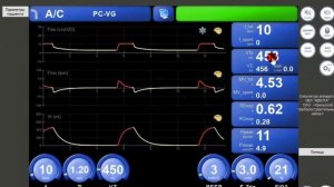 Симулятор АВЕНТА А_С-CMV-PC-VG (Л.№3) Горячев А.С