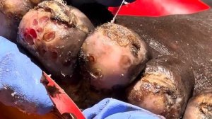 Heavily jiggered Patrick’s right foot - watch juicy full video @riseupsociety.net