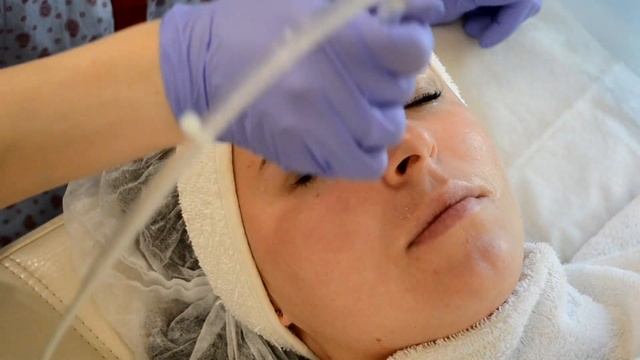 Газорідинний пілінг смотреть онлайн