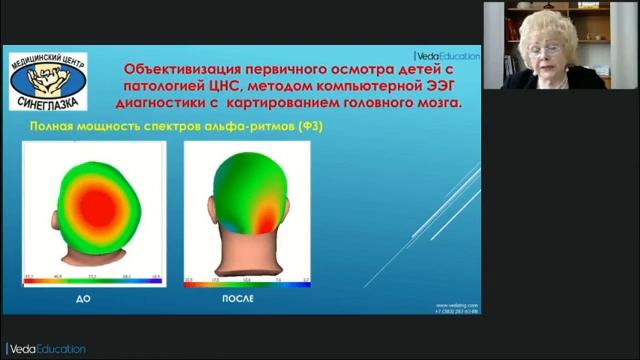 Роль пробиотиков в вопросах реабилитации неврологических пациентов детского возраста