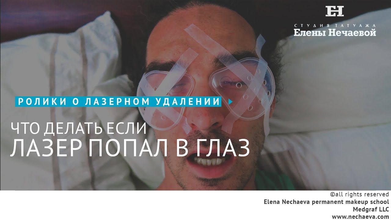 Что делать, если лазер попал в глаз? #татуаж #удалениелазером