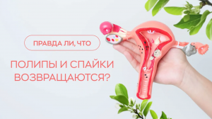 ? Правда ли, что полипы и спайки возвращаются?