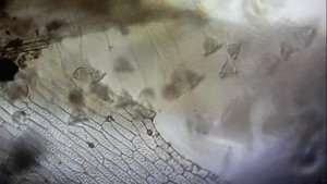 Инфузории сувойки