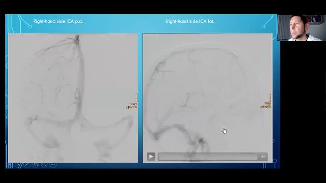 STEFAN SCHOB смотреть онлайн