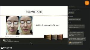 Протокол контурной коррекции "Face Art" с использованием филлеров Platinum