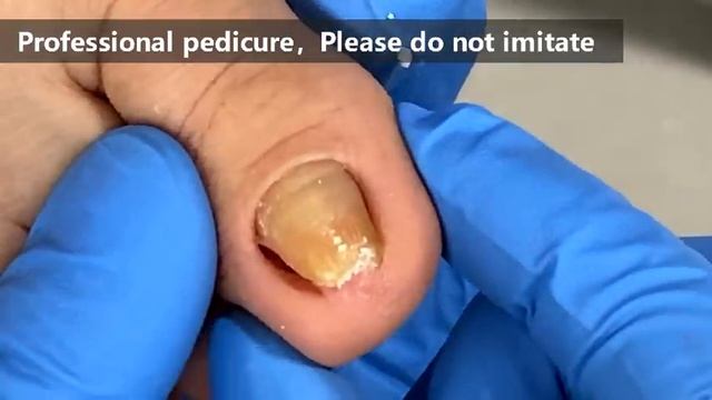 Pedicure tutorial ：small yellow nails【Xue Yidao】 смотреть онлайн