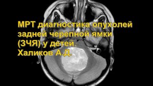 МРТ диагностика опухолей задней черепной ямки у детей  Халиков А Д