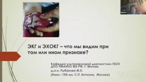 ЭКГ и ЭхоКГ – Что мы видим при том или ином признаке